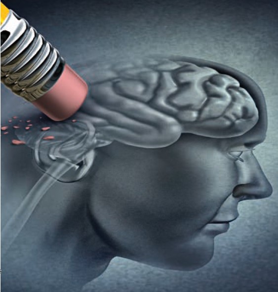 Demenz Blog - Neuroinflammation verringert